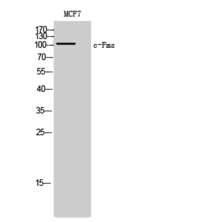 Western Blot - Anti-M-CSF Receptor Antibody (B0679) - Antibodies.com