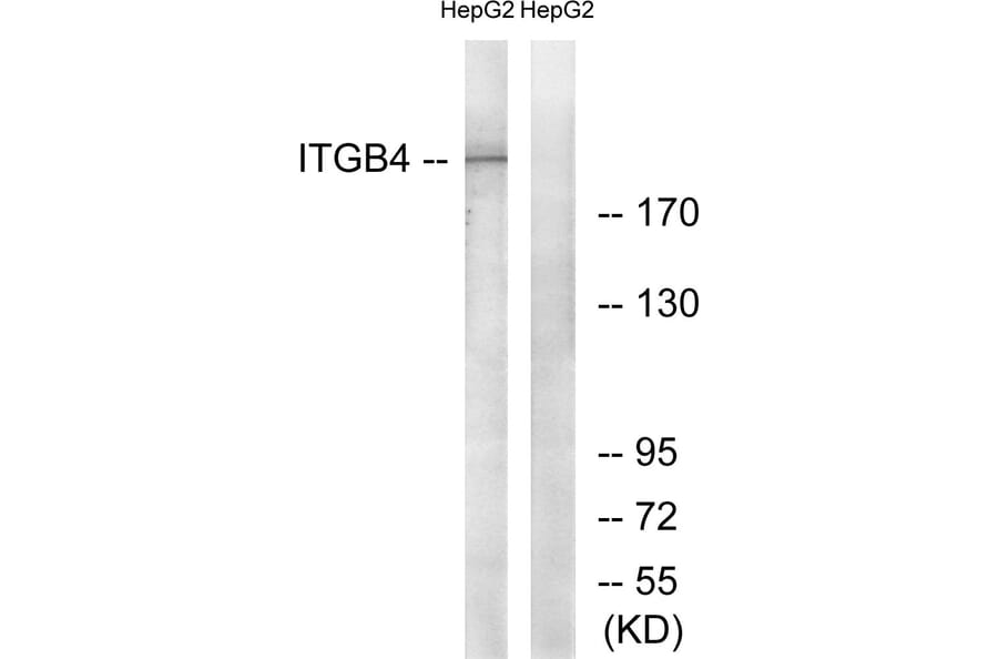 Western Blot - Anti-Integrin beta4 Antibody (B1078) - Antibodies.com
