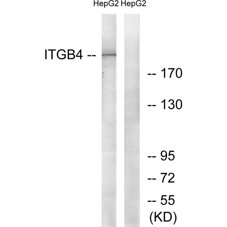 Western Blot - Anti-Integrin beta4 Antibody (B1078) - Antibodies.com