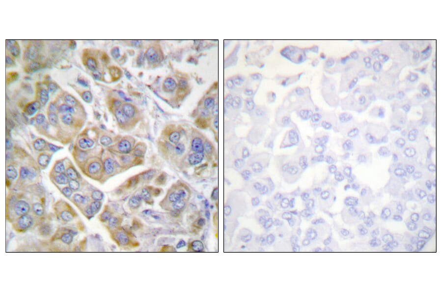 Immunohistochemistry - Anti-Integrin beta4 Antibody (B1078) - Antibodies.com