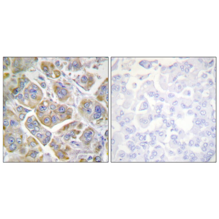 Immunohistochemistry - Anti-Integrin beta4 Antibody (B1078) - Antibodies.com