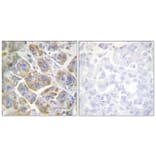 Immunohistochemistry - Anti-Integrin beta4 Antibody (B1078) - Antibodies.com