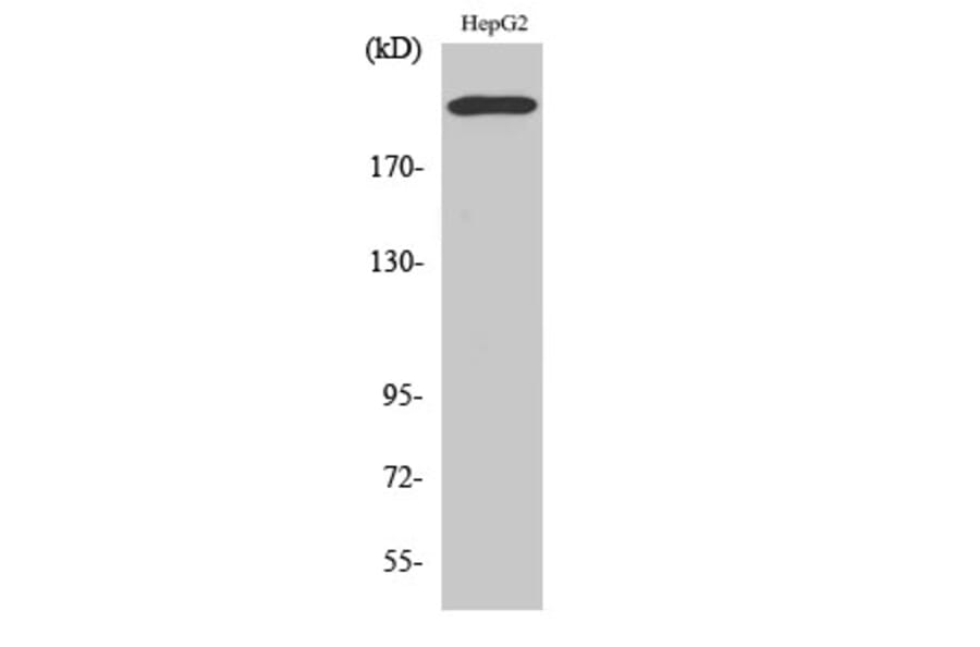Western Blot - Anti-Integrin beta4 Antibody (B1078) - Antibodies.com