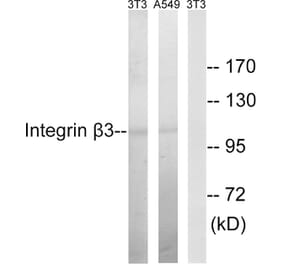 Western Blot - Anti-Integrin beta3 Antibody (B7119) - Antibodies.com
