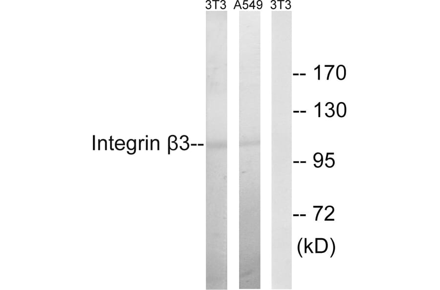Western Blot - Anti-Integrin beta3 Antibody (B7119) - Antibodies.com