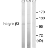 Western Blot - Anti-Integrin beta3 Antibody (B7119) - Antibodies.com