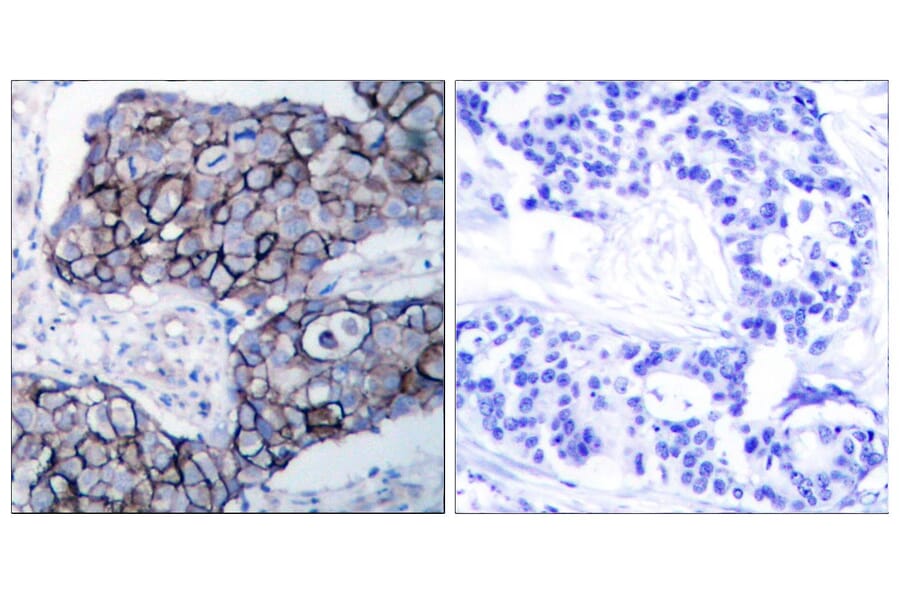 Immunohistochemistry - Anti-Integrin beta3 Antibody (B7119) - Antibodies.com