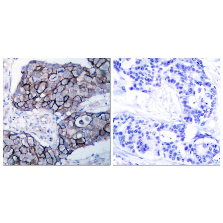 Immunohistochemistry - Anti-Integrin beta3 Antibody (B7119) - Antibodies.com
