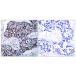 Immunohistochemistry - Anti-Integrin beta3 Antibody (B7119) - Antibodies.com