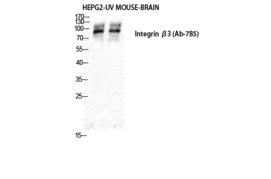 Western Blot - Anti-Integrin beta3 Antibody (B7119) - Antibodies.com