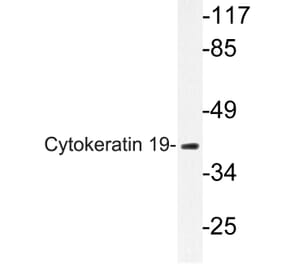 Western Blot - Anti-Cytokeratin 19 Antibody (R12-2109) - Antibodies.com