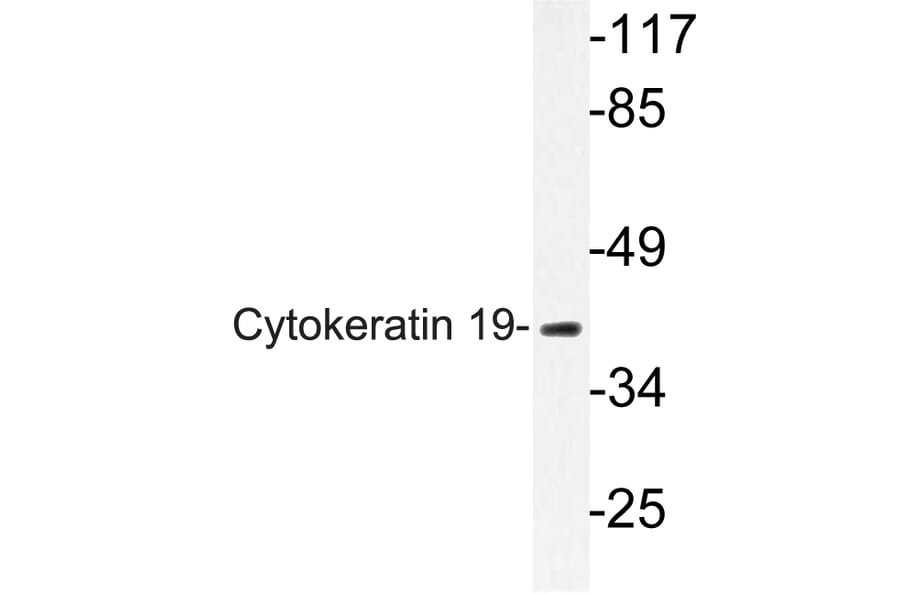 Western Blot - Anti-Cytokeratin 19 Antibody (R12-2109) - Antibodies.com