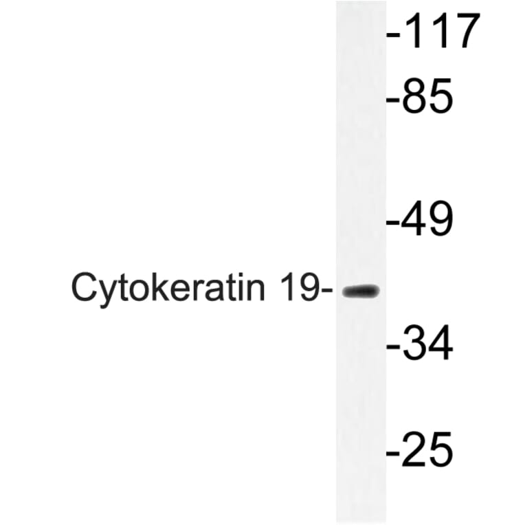 Western Blot - Anti-Cytokeratin 19 Antibody (R12-2109) - Antibodies.com