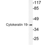 Western Blot - Anti-Cytokeratin 19 Antibody (R12-2109) - Antibodies.com