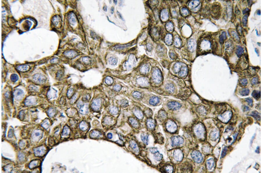 Immunohistochemistry - Anti-Cytokeratin 19 Antibody (R12-2109) - Antibodies.com