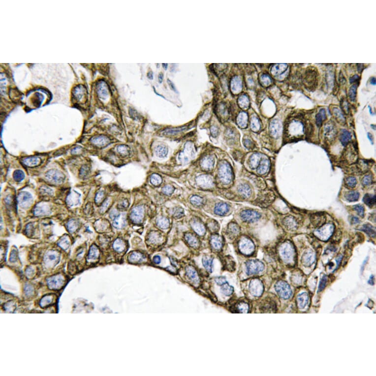 Immunohistochemistry - Anti-Cytokeratin 19 Antibody (R12-2109) - Antibodies.com