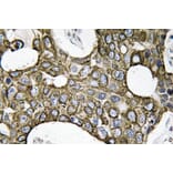 Immunohistochemistry - Anti-Cytokeratin 19 Antibody (R12-2109) - Antibodies.com