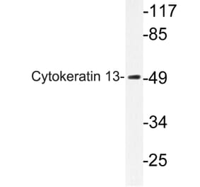 Western Blot - Anti-Cytokeratin 13 Antibody (R12-2106) - Antibodies.com