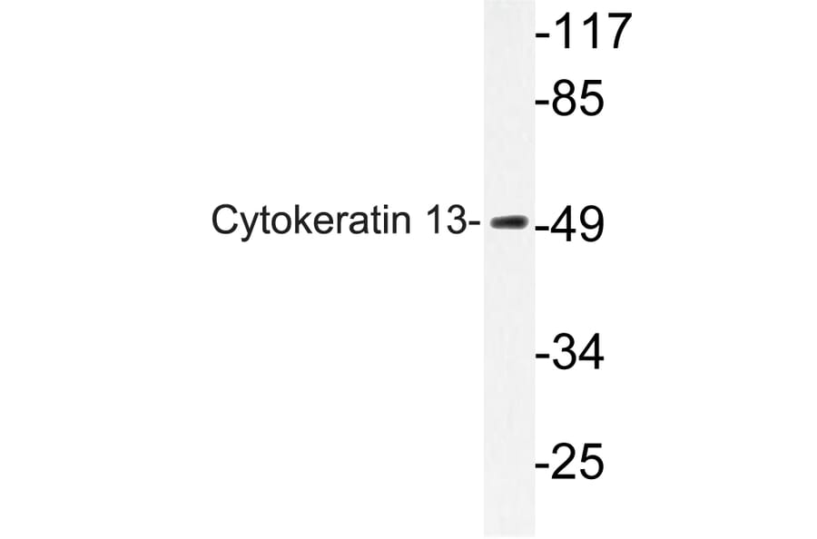 Western Blot - Anti-Cytokeratin 13 Antibody (R12-2106) - Antibodies.com