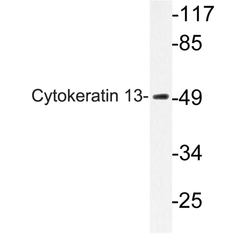 Western Blot - Anti-Cytokeratin 13 Antibody (R12-2106) - Antibodies.com