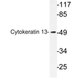 Western Blot - Anti-Cytokeratin 13 Antibody (R12-2106) - Antibodies.com