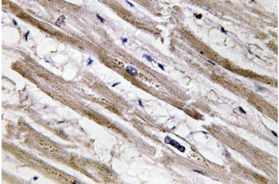 Immunohistochemistry - Anti-Cytokeratin 13 Antibody (R12-2106) - Antibodies.com
