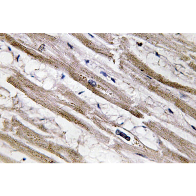 Immunohistochemistry - Anti-Cytokeratin 13 Antibody (R12-2106) - Antibodies.com