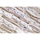 Immunohistochemistry - Anti-Cytokeratin 13 Antibody (R12-2106) - Antibodies.com