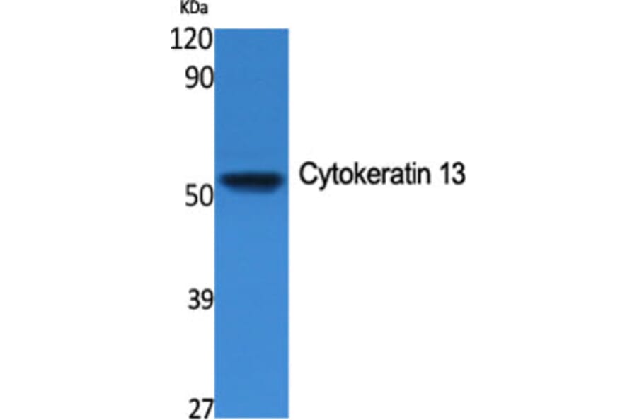 Western Blot - Anti-Cytokeratin 13 Antibody (R12-2106) - Antibodies.com