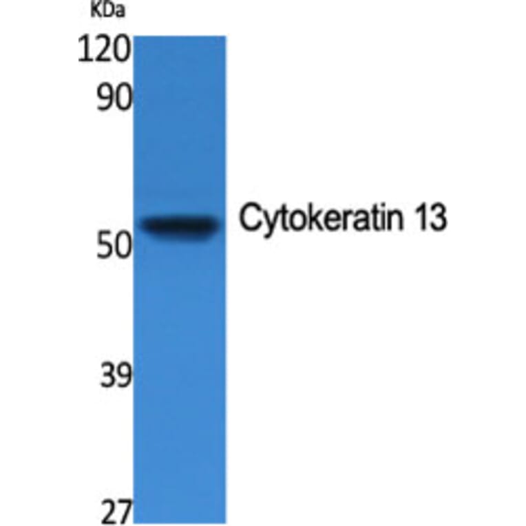 Western Blot - Anti-Cytokeratin 13 Antibody (R12-2106) - Antibodies.com