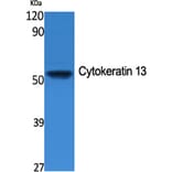 Western Blot - Anti-Cytokeratin 13 Antibody (R12-2106) - Antibodies.com