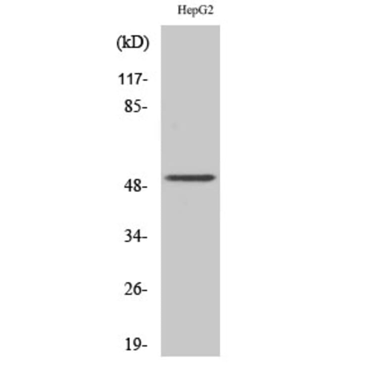 Western Blot - Anti-Cytokeratin 13 Antibody (R12-2106) - Antibodies.com