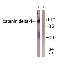 Western Blot - Anti-Catenin-delta1 Antibody (B0891) - Antibodies.com