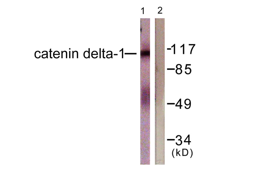 Western Blot - Anti-Catenin-delta1 Antibody (B0891) - Antibodies.com