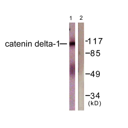 Western Blot - Anti-Catenin-delta1 Antibody (B0891) - Antibodies.com
