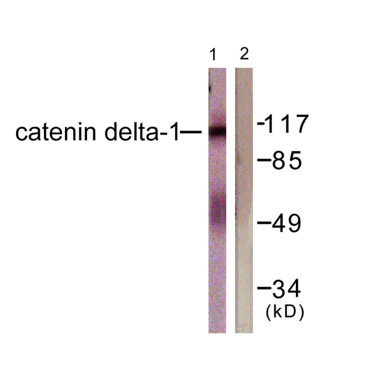 Western Blot - Anti-Catenin-delta1 Antibody (B0891) - Antibodies.com