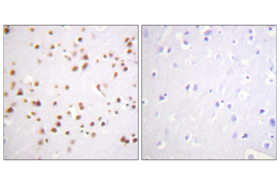Immunohistochemistry - Anti-Catenin-delta1 Antibody (B0891) - Antibodies.com