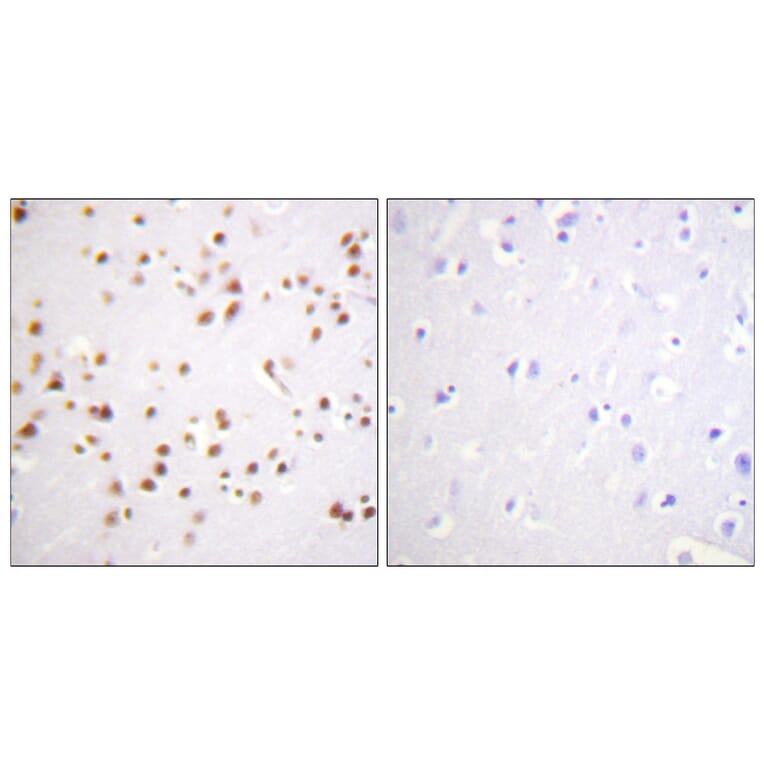 Immunohistochemistry - Anti-Catenin-delta1 Antibody (B0891) - Antibodies.com
