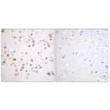 Immunohistochemistry - Anti-Catenin-delta1 Antibody (B0891) - Antibodies.com
