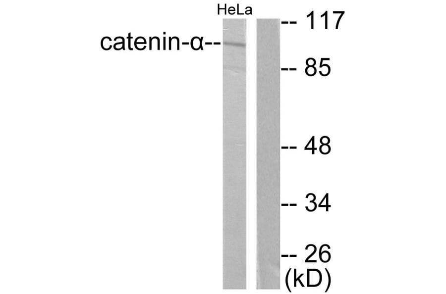 Western Blot - Anti-Catenin-alpha1 Antibody (C0137) - Antibodies.com