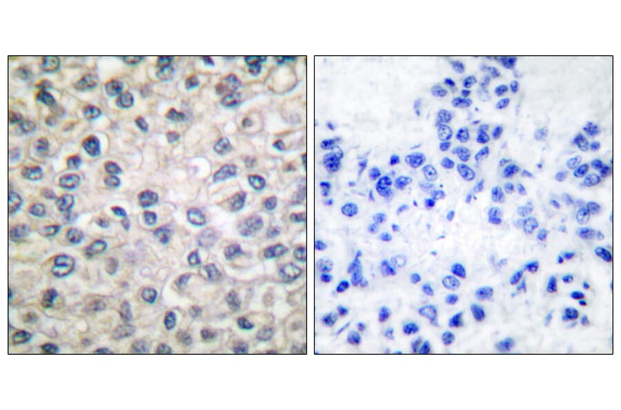 Immunohistochemistry - Anti-Catenin-alpha1 Antibody (C0137) - Antibodies.com