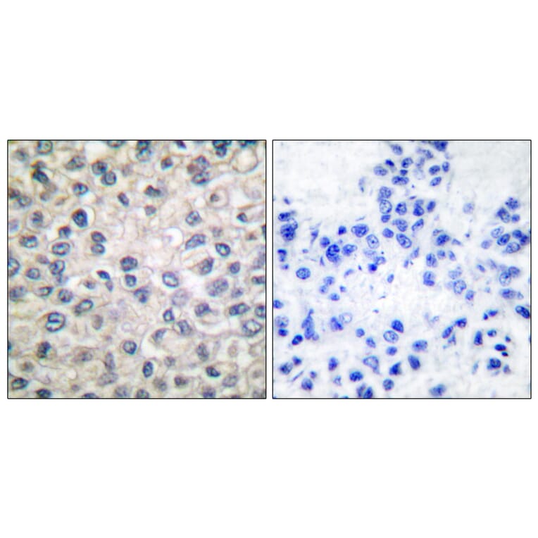 Immunohistochemistry - Anti-Catenin-alpha1 Antibody (C0137) - Antibodies.com