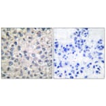 Immunohistochemistry - Anti-Catenin-alpha1 Antibody (C0137) - Antibodies.com