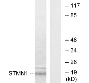 Western Blot - Anti-Stathmin 1 Antibody (B7230) - Antibodies.com