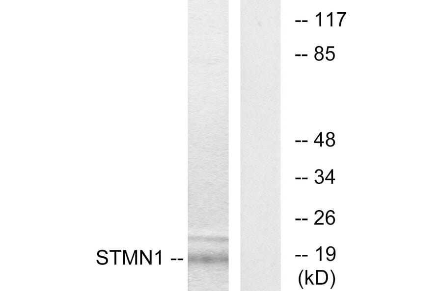 Western Blot - Anti-Stathmin 1 Antibody (B7230) - Antibodies.com