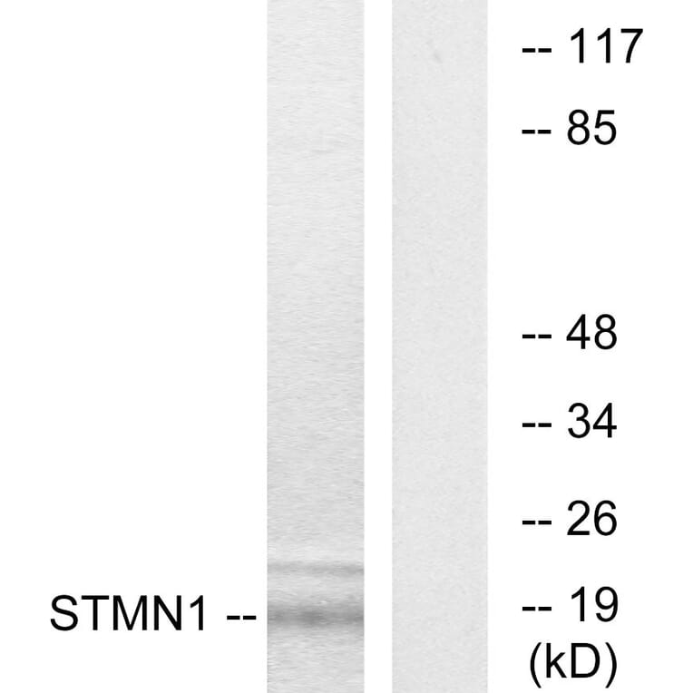 Western Blot - Anti-Stathmin 1 Antibody (B7230) - Antibodies.com