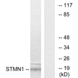 Western Blot - Anti-Stathmin 1 Antibody (B7230) - Antibodies.com