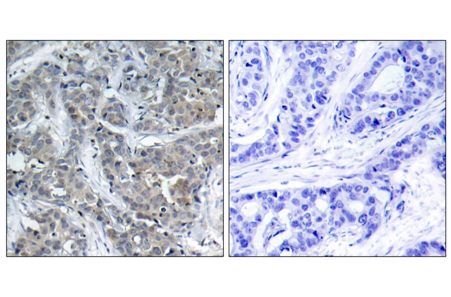 Immunohistochemistry - Anti-Stathmin 1 Antibody (B7230) - Antibodies.com