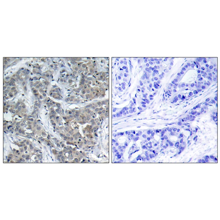 Immunohistochemistry - Anti-Stathmin 1 Antibody (B7230) - Antibodies.com