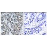 Immunohistochemistry - Anti-Stathmin 1 Antibody (B7230) - Antibodies.com